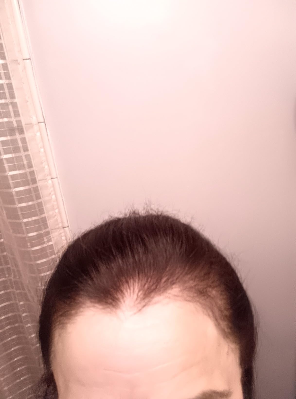 Hair Growth Serum Scalp Treatment: Scalp Serum with Rosemary, Multi-Peptide & Caffeine for Anti Hair Loss and Thinning - Thickening and Density for Women & Men customer photo 1