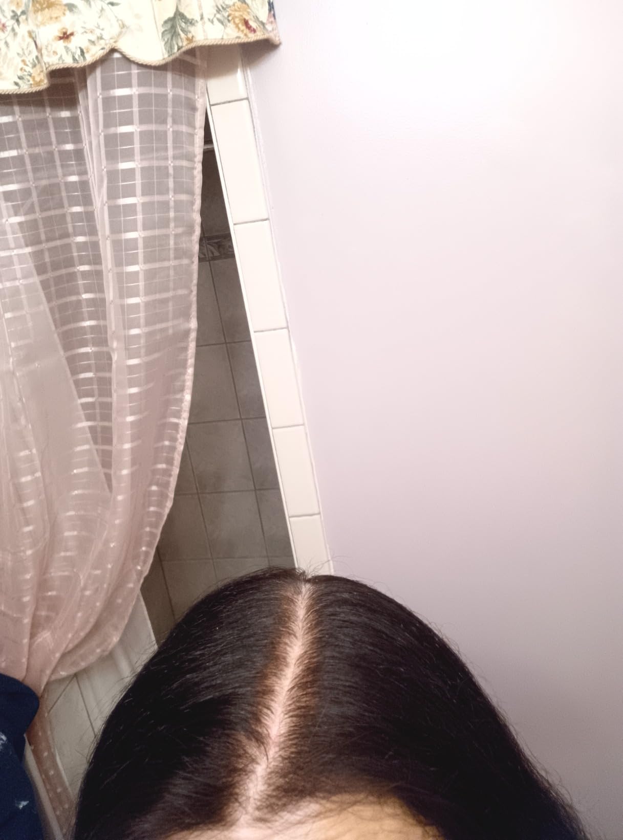 Hair Growth Serum Scalp Treatment: Scalp Serum with Rosemary, Multi-Peptide & Caffeine for Anti Hair Loss and Thinning - Thickening and Density for Women & Men customer photo 2