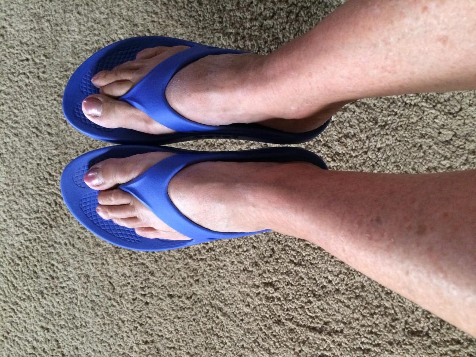 OOFOS OOlala Women's Sandal - Lightweight Recovery Footwear - Reduces Stress on Feet, Joints & Back - Machine Washable customer photo 1
