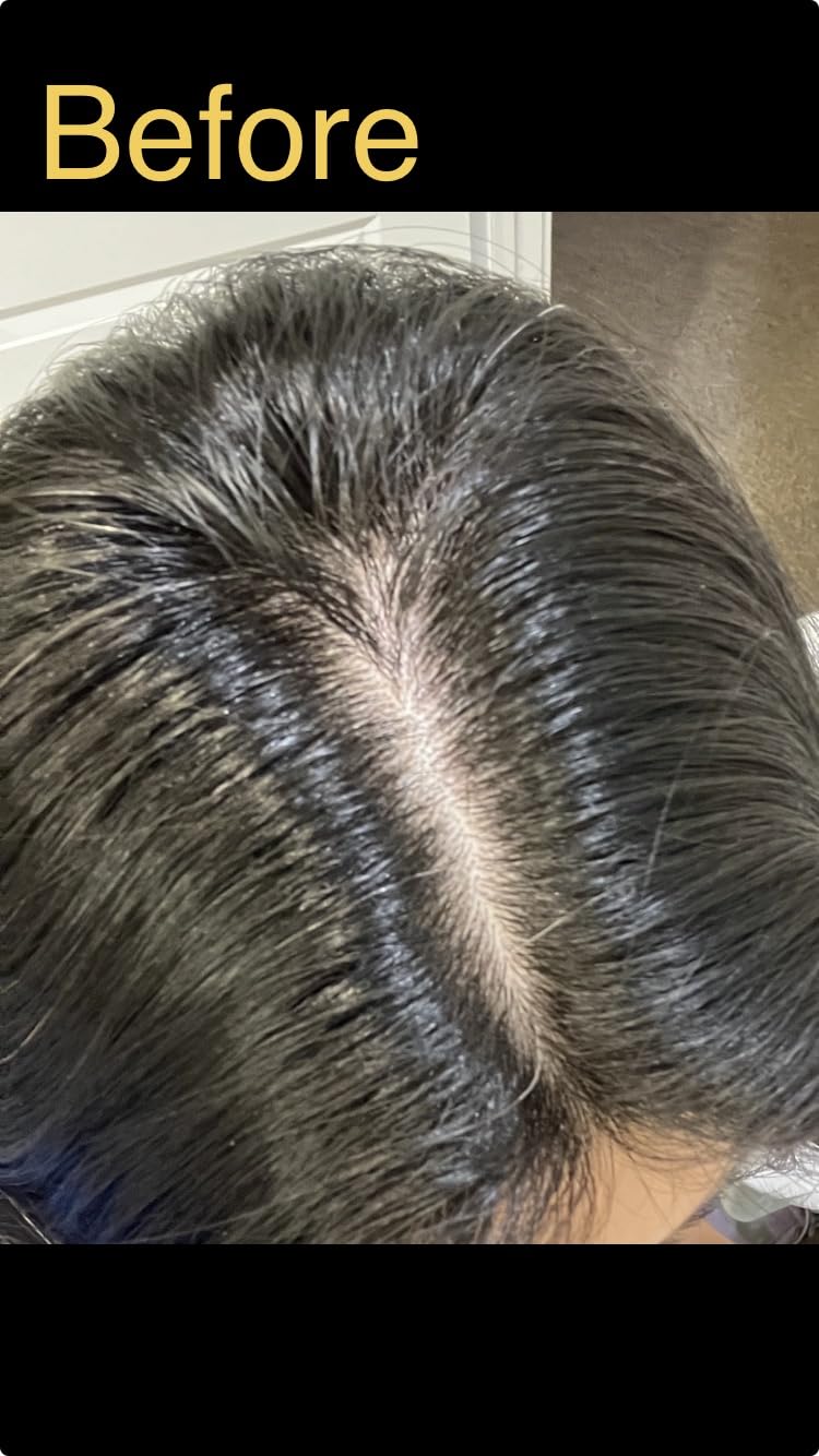 lilyeve GROWTURN Exosome Hair Growth Serum with Built-In Brush, 3.38 fl oz customer photo 2